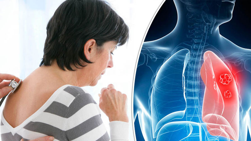 El gas Radón puede provocar cancer de pulmón.